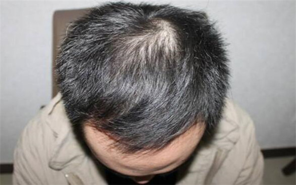 南昌三甲醫(yī)院全面盤點(diǎn)：專業(yè)美容整形醫(yī)院推薦，趕緊了解一下！