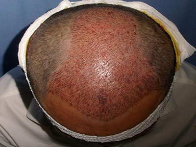 南通最佳祛斑醫(yī)院推薦！康美醫(yī)療第二，維多利亞給力薦！