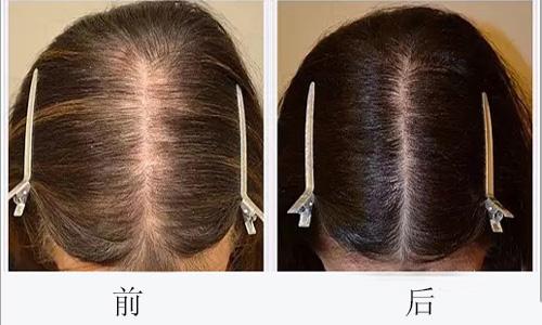 臺州牙科，哪家醫(yī)院效果好？公立私立都有，適合每個人的最佳選擇！