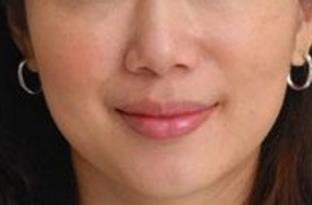 鄭州面部綜合化抗衰醫(yī)生