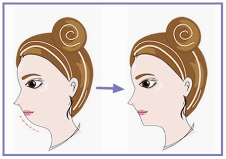 蘭州整形醫(yī)院排行榜出爐！選擇最滿意的吸脂抽脂醫(yī)院！