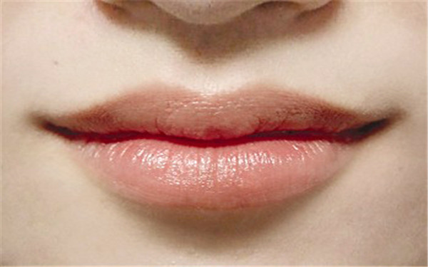 大連小切口祛除面部皺紋醫(yī)生