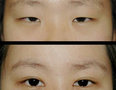 北大醫(yī)院整形科的熱門醫(yī)生推薦！【引領(lǐng)潮流，實力強大】