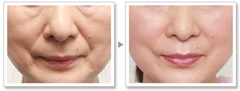 南充皮膚修復(fù)中心：精心挑選的6家洗紋身醫(yī)院，達芬奇、韓美榜上集結(jié)