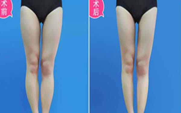 南昌牙科醫(yī)院脫穎而出！德韓、德亞口腔品牌技術引領