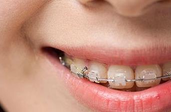 濟(jì)寧面部皺紋除皺針醫(yī)生