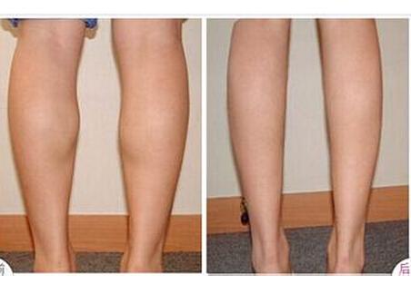 廣州脫發(fā)醫(yī)院排行榜：這些醫(yī)療機構讓你恢復美麗發(fā)際線！