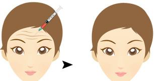寧波整容中心熱門推薦：選擇三家技術(shù)頂尖的醫(yī)院，你會喜歡其中一家嗎？