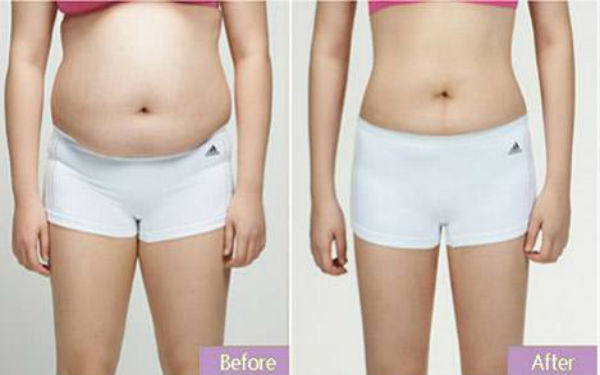 常德眼袋手術(shù)推薦排名TOP10！公私醫(yī)院詳細(xì)對(duì)比，看看你選對(duì)了沒(méi)有