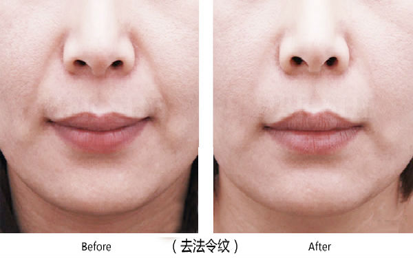 寶雞整容醫(yī)院大整頂級優(yōu)質(zhì)匯總！高一生對決愛容妍_絕對實力的對比震撼