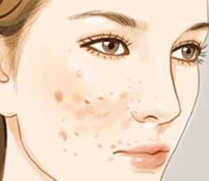 廣州植發(fā)醫(yī)院TOP7匯總-公立、私立對比及口碑分享，前三口碑極佳，性價比超高！