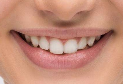 寧波五家信譽(yù)好、性價(jià)比高的植發(fā)醫(yī)院全景評(píng)測，匯總榜單前五強(qiáng)