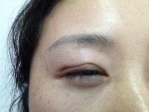 廣州隆鼻手術(shù)：挑選最好的醫(yī)生，口碑盤點！是否有你最滿意的專家？