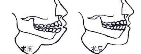 太原祛疤醫(yī)院推薦：多家專業(yè)機構為您帶來有效祛疤方案!