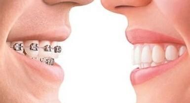 大連地區(qū)脫發(fā)問題加劇？找到合適植發(fā)醫(yī)院，解決困擾！