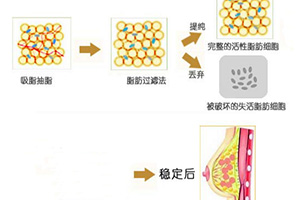 哪位醫(yī)生在八大處做雙眼皮效果最好？最受歡迎的五個口碑推薦！勢頭強(qiáng)勁！