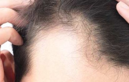 國內(nèi)頂級面部脂肪填充醫(yī)院盤點(diǎn)：頂尖專業(yè)團(tuán)隊(duì)，選擇一定不后悔！