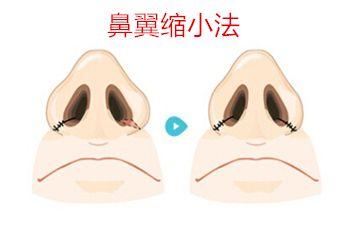 天津疤痕治療醫(yī)院推薦！這5家專業(yè)醫(yī)院排名前列！