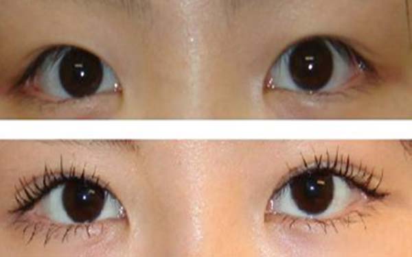 廣東疤痕修復(fù)專科醫(yī)院榜單：8家被推薦的醫(yī)院表現(xiàn)出色