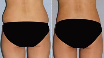 成都最受好評(píng)的整形醫(yī)院匯總，專業(yè)拉皮手術(shù)效果一流