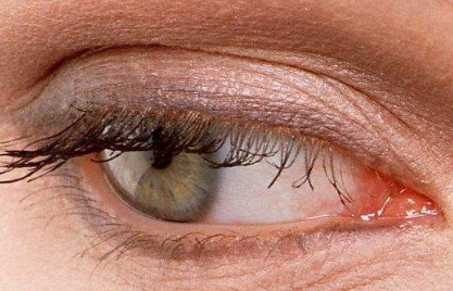 杭州哪家眼部整形醫(yī)院比較靠譜？浙江雙眼皮整形醫(yī)院排行榜TOP7！