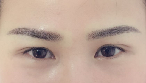 揭秘玉溪整形醫(yī)院匯總：華藝、吳氏嘉美等排行前六，此刻揭開(kāi)！