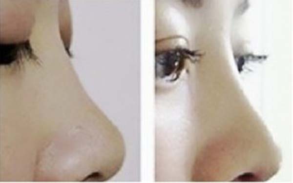 揭秘深圳三家知名整容機構(gòu)，助你尋找信賴的美容醫(yī)院