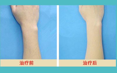 最新發(fā)布！匯總?cè)箩t(yī)院名單，解決牙齒問題待了整整一年