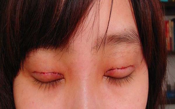 成都整形醫(yī)院修復(fù)隆鼻排行榜：前五強(qiáng)醫(yī)療機(jī)構(gòu)值得推薦！