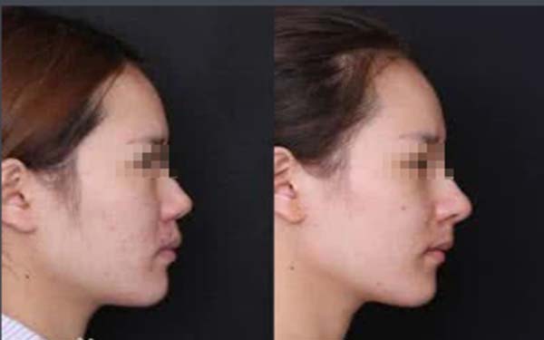 惠州市區(qū)最受好評(píng)的整形醫(yī)院有哪些？推薦這4家在市內(nèi)名聲鵲起的醫(yī)院