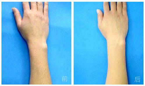 昆山五家實(shí)力強(qiáng)勁的吸脂醫(yī)院，百達(dá)麗強(qiáng)勢(shì)領(lǐng)跑