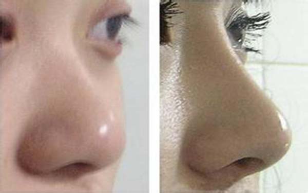 杭州口碑最佳的整形醫(yī)院盤(pán)點(diǎn)！匯總七家頂級(jí)醫(yī)療機(jī)構(gòu)，專(zhuān)注為您帶來(lái)品質(zhì)醫(yī)美服務(wù)