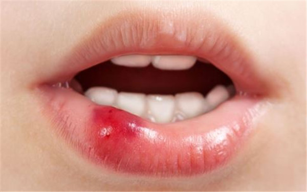 佛山澳洲mmV膠原蛋白肽美白醫(yī)生