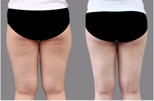 廣西整形醫(yī)院精選！當(dāng)紅top6醫(yī)院名單曝光，人氣首選聚焦簡介