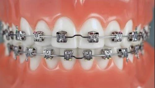 昆明頂級(jí)牙科醫(yī)院排行榜出爐！整牙專家力壓群雄，技術(shù)高超