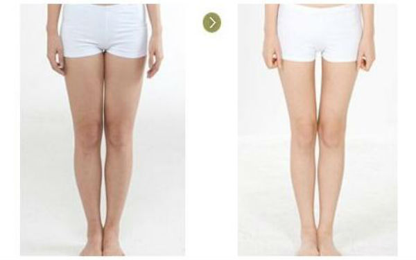 成都哪家醫(yī)院胸部整形排名第一？這幾家一定讓你滿意！