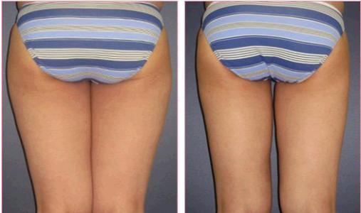 廊坊三河最佳整形醫(yī)院獨占前五！專家實力堪比頂尖！