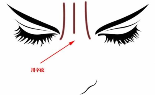 成都雙眼皮修復(fù)手術(shù)：五家性價(jià)比高、技術(shù)好的醫(yī)院推薦