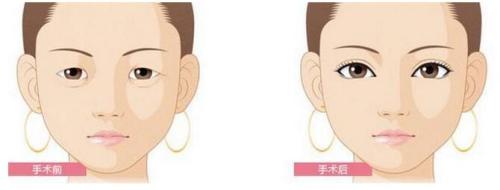 永州祛斑好的醫(yī)院排行榜前六甄選，你值得了解