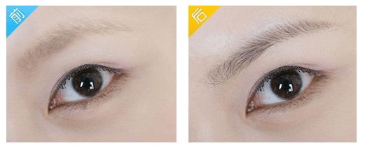 浙江哪個地方可以有效治療疤痕？優(yōu)質(zhì)機構(gòu)入圍省內(nèi)六地8家！