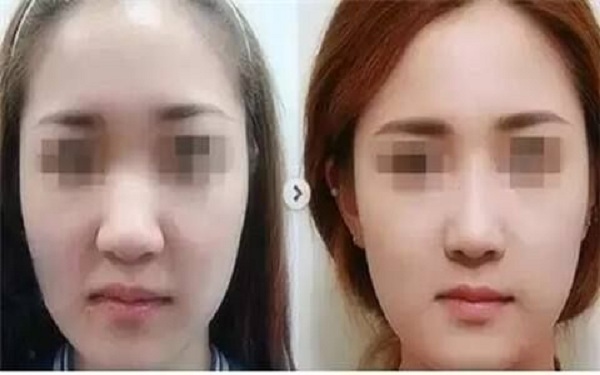 濰坊整形醫(yī)院推薦！這三家綜合評(píng)價(jià)絕對(duì)出眾