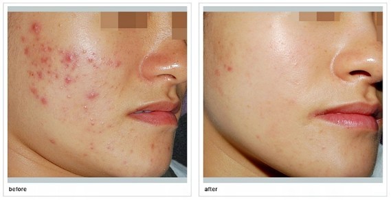 煙臺(tái)市牙齒種植最佳醫(yī)院匯總：哪家醫(yī)院值得選擇？一文速覽享知！