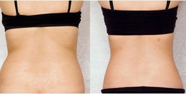 湖州湖人眼袋醫(yī)院TOP5，曙光與唯美齊爭魁！