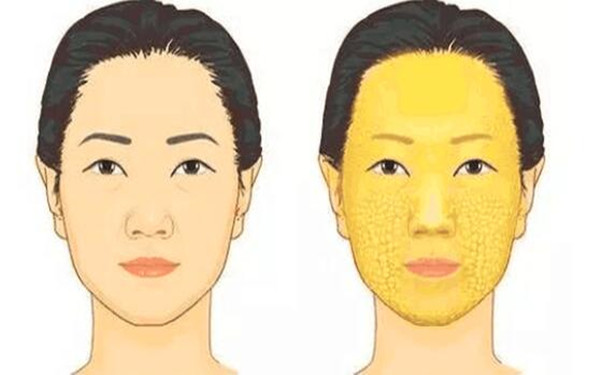 滄州治療疤痕的正規(guī)醫(yī)院推薦：專業(yè)科技祛疤，效果顯著！點擊了解！