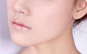 北京眼部細(xì)紋打除皺針醫(yī)生