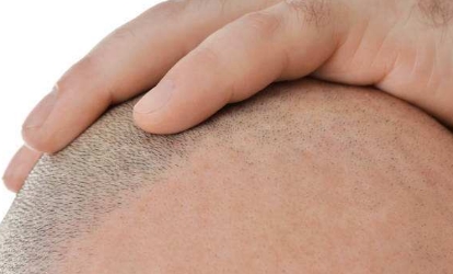 深圳最熱門的拉皮手術(shù)醫(yī)生推薦！值得信賴的十大醫(yī)師名單發(fā)布！