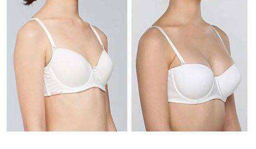 湖州激光去頸紋手術醫(yī)生