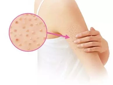 浙江哪家整形醫(yī)院最受歡迎？浙江前五強推薦！