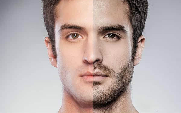 河南整形醫(yī)院的最佳選擇，讓您告別煩惱的去皮脂腺痣解決方案！六大推薦醫(yī)院匯總