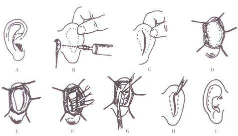 深圳眼部整形業(yè)內(nèi)杰出醫(yī)生盤(pán)點(diǎn)！錯(cuò)過(guò)可惜，快來(lái)查看！
